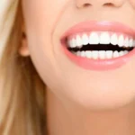 najboljsi-nacin-za-odstranjevanje-zobnih-oblog-ki-vas-bo-presenetil.webp.webp